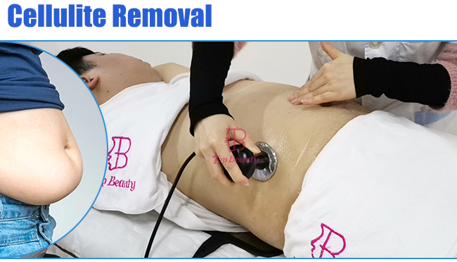 Smart Tecar Therapy Machine Pain Management Equipment 1000hrz