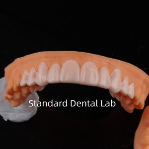 Wholesale High Esthetics Dental Snap On Smile Standard Dental Lab from china suppliers