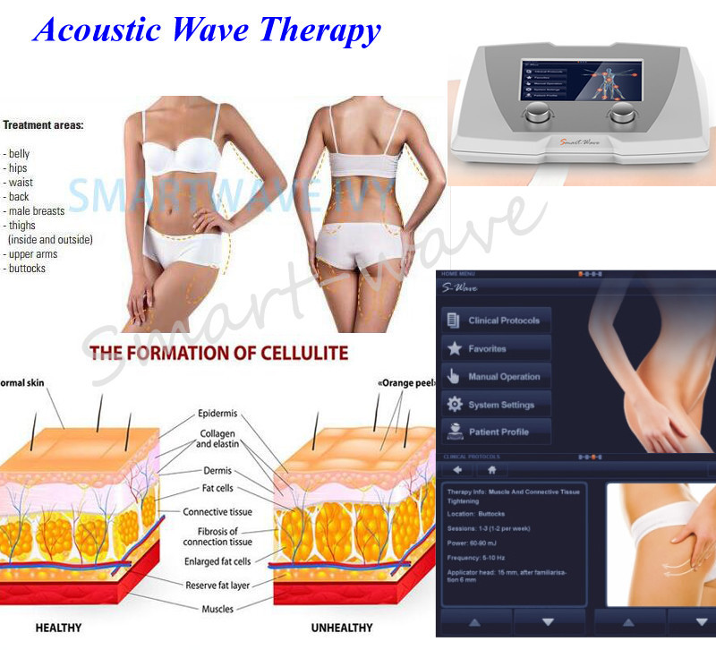 Beauty Acoustic Wave Therapy For Cellulite 4rd Gen Magnetic Electric Source