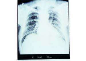 Wholesale Chest Medical X Ray Dry Film Thermal Printer For AGFA 14in x 17in from china suppliers
