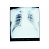 Buy cheap Medical Dry Imaging Film X-ray For AGFA 5300 / 5302 / 5500 KND-A from wholesalers