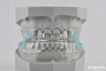 Adults Silicone Transparent Snoring Device Snore Stopper Tool Transparent Color