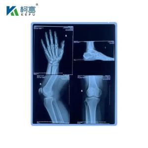 Wholesale Blue PET Based X Ray Inkjet / Laser Film Medical Images For Clinic And Hospitals from china suppliers