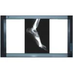 Holographic Medical Imaging Film , Thermal Printers PET X Ray Film