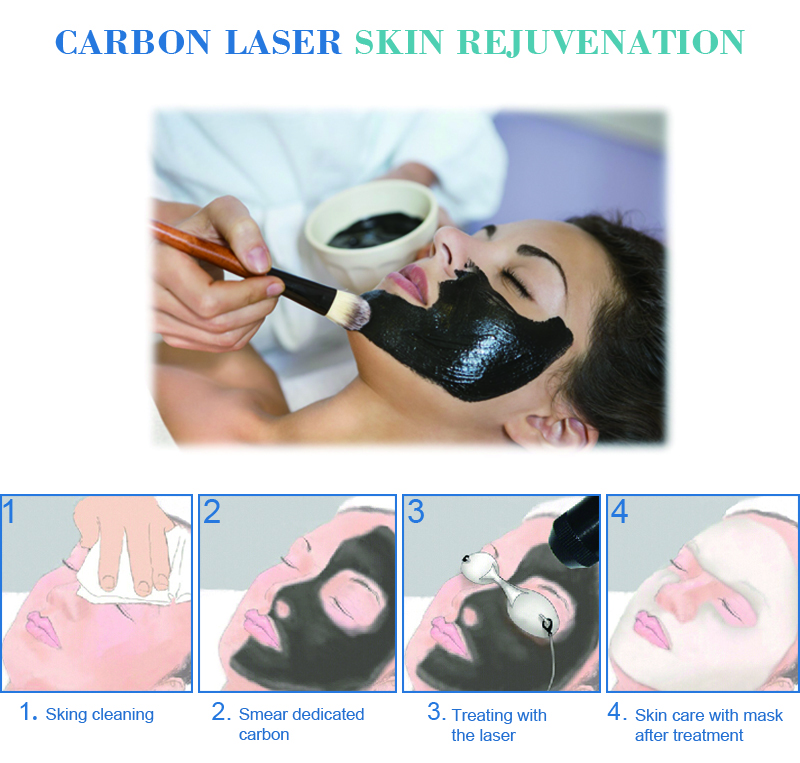 Professional 600ps picosure picosecond machine Q Switched nd Yag Laser tattoo removal
