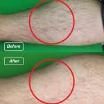 755nm Alexandrite Laser 1064nm Long Pulse Nd Yag Laser Hair Removal Stationary