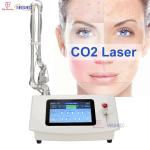 Surgical Fractional Co2 Laser Yag Laser Carbon Acne Scar Removal Wrinkle