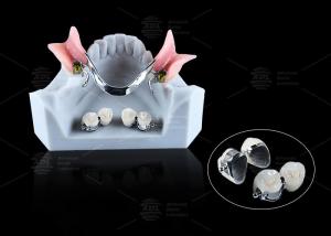 Wholesale CE FDA Ball Attachment Dentures Comfortable Denture Ball Attachment Long Lasting from china suppliers