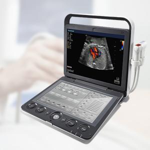 Wholesale Sonoscape S9 Pregnant Baby Medical Diagnosis 4D Color Doppler Sonography Machine Portable Ultrasound from china suppliers