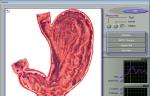 Quantum Magnetic Resonance 3d Nls Health Analyzer , Win XP Win 7
