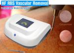 300 Watts Varicose Veins Laser Treatment Equipment