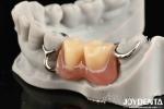 Stable Oral Structure For Dental Professionals In Firmly Connect The Row Teeth