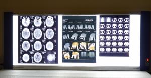 Wholesale 10in * 14in Digital x-ray Dry Medical Imaging Films For Thermal Printers KND-F from china suppliers