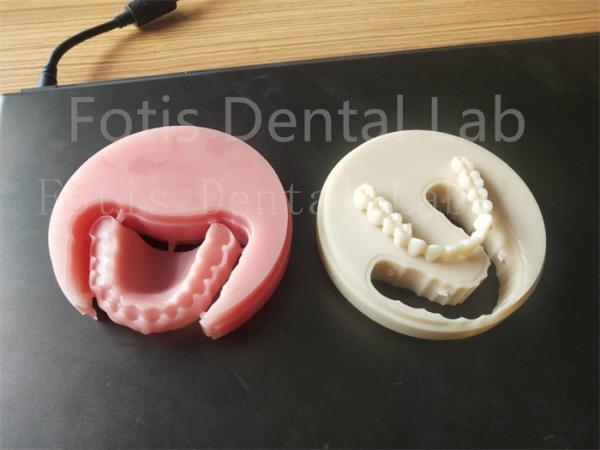 Comfort Fit Full Acrylic Dental Prosthesis For Professional Technicians Easy To