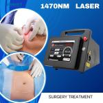 15W/20W 1470nm Endolaser for Liftinging Facial Lipolysis and Endovenous Laser