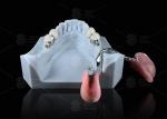 Sleek Precision ERA Dental Attachments For Universal Secure Dental Prosthetics