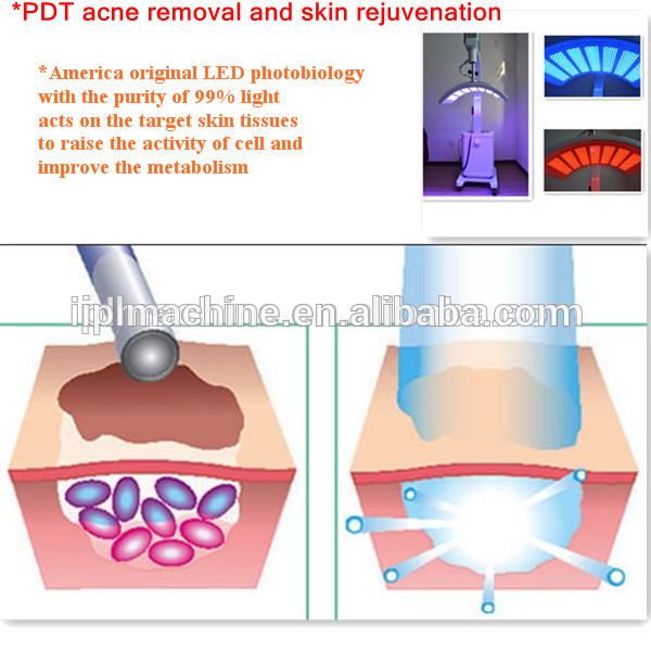 Professional PDT Beauty Machine Best Price Led Machine for Beauty