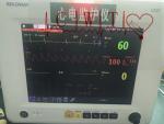 12.1'' TFT Multi Parameter Vital Signs Monitor Repair , Adult Healthcare