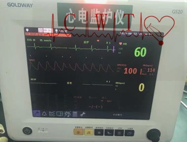 12.1'' TFT Multi Parameter Vital Signs Monitor Repair , Adult Healthcare