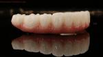 High Quality Dental zirconia crown and All On Four Six Implant Full Arch / China