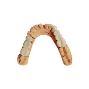 Wholesale Color Stable PFM Dental Crown Acid And Alkali Resistance Not Easy To Wear from china suppliers