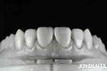 Revolutionize Your Dental Practice with Natural Tooth Morphology Tooth