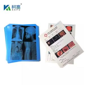 Wholesale Medical Laser Film With High Color Accuracy And Fidelity 14x18in 0.16mm For True - To - Life Diagnostic Images from china suppliers