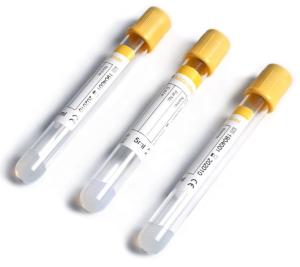 Wholesale CE ISO Vacuum Blood Collection Tube with Coagulant and Separation Gel 2ml 8ml Glass PET from china suppliers