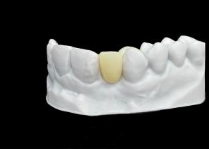 Wholesale Chipping Resistance Zirconia dental Crown With Exceptional Strength And Translucency from china suppliers