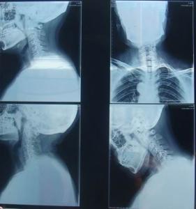 Wholesale KND-K Scratch-resistant Medical Paper Dry Imaging Film For Radiographic Examination from china suppliers