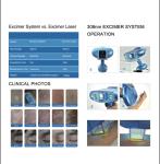 High energy, curative effect 308nm excimer laser system for vitiligo,psoriasis