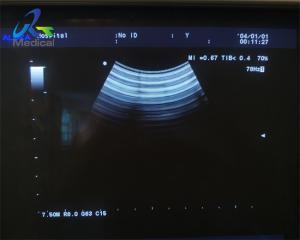 Wholesale Aloka ASU-1010 Ultrasound Transducer Probe 4D And Cable Repair from china suppliers
