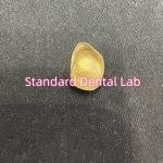 Non Precious Yellow Metal Alloy Crown Full Cast With Zirconia Crown