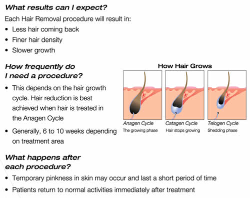 12*20 big spot 808nm diode laser hair removal machine no pains with strong cooling systems