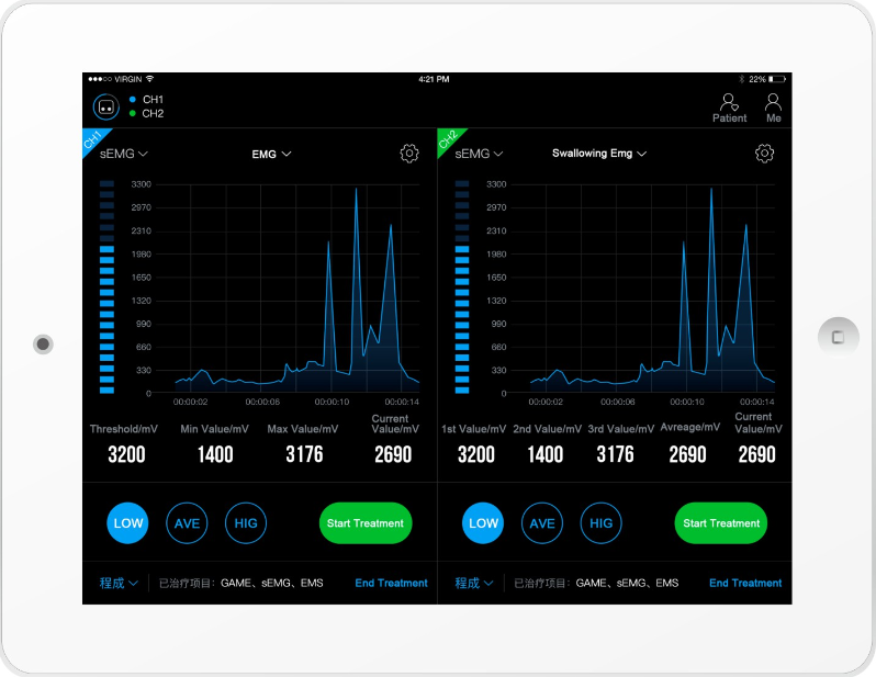 High Speed Emg Biofeedback Equipment Customize Treatment For Stroke Patients