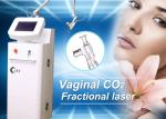 White CE Tighten Skin Fractional Co2 Laser Treatment For Stretch Marks , 36