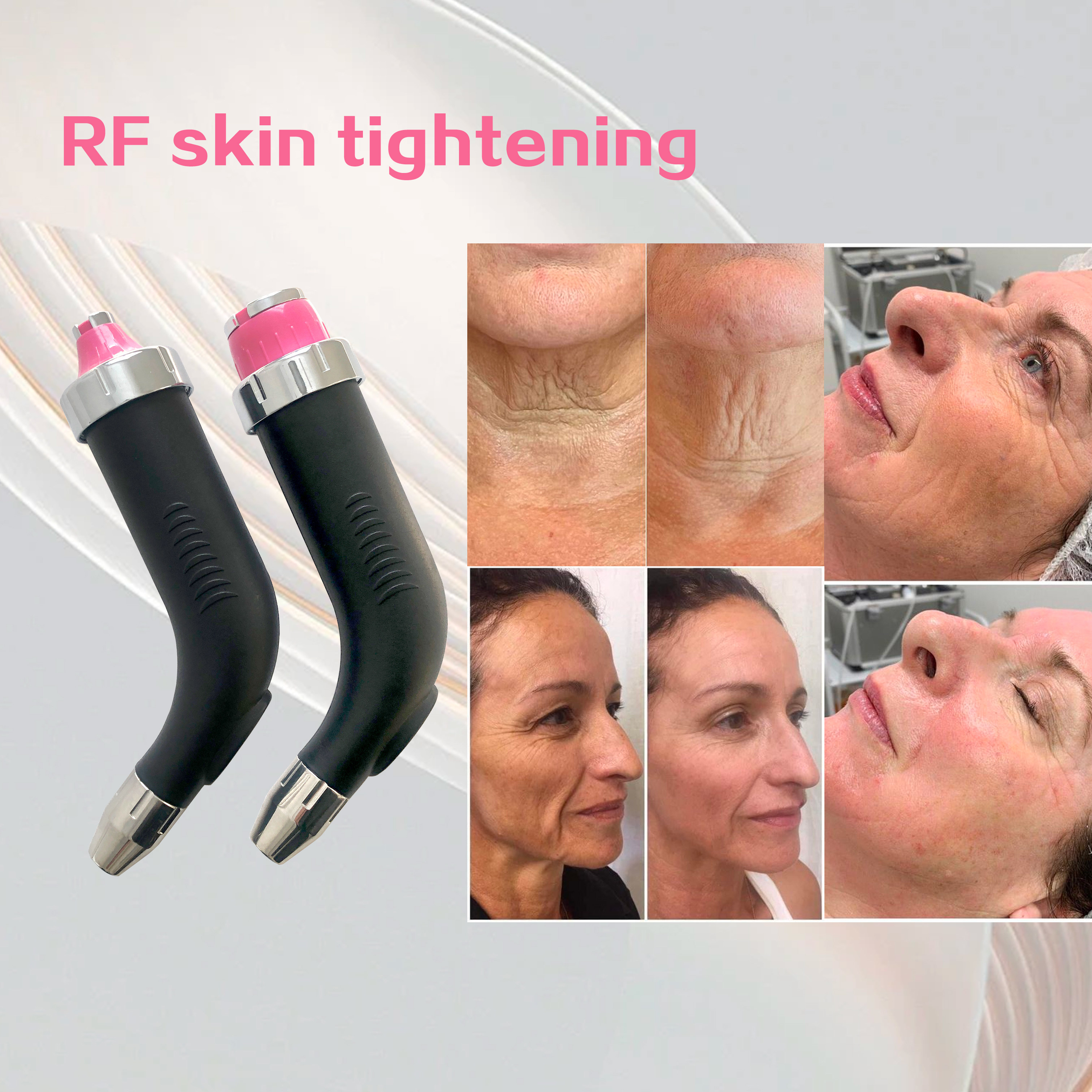 Multifunctional IPL RF DIODE LASER ND YAG LASER tattoo removal and hair removal skin rejuvenation salon use