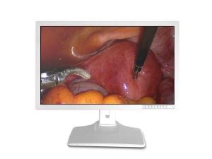 Wholesale HDMI VGA Medical Display 32 Inch 4k Monitor from china suppliers