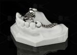 Repairable Cobalt Chromium Dental Metal Framework Partial Denture
