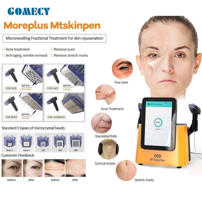 Morpheus 8 Face Lift Beauty Gold Microneedling Machine Skin Rejuvenation For Wrinkle Removal