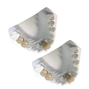 Wholesale Good Mechanical Porcelain Metal Crowns Yellow Gold High Strength from china suppliers