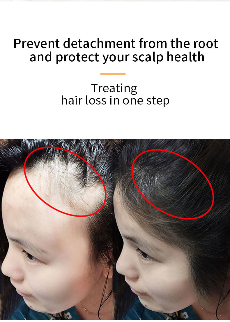 30ml Hair Growth Serum