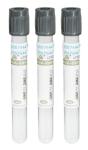 CE ISO Vacuum Blood Collection Tube with Sodium Fluoride/Potassium Oxalate 2ml