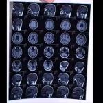 Medical X Ray Film Dry Thermal For Printer