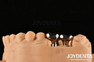 Wholesale Silver Dental Implant Abutments Customizable Diameter Height CAD CAM Technology from china suppliers