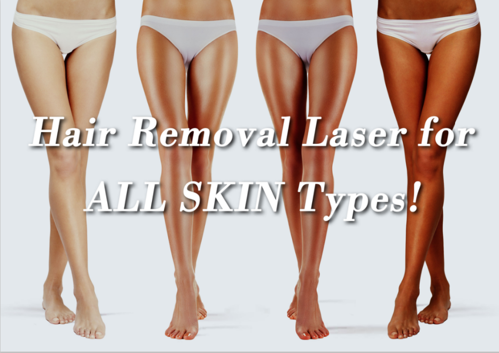 1200w Sincoheren 808nm Diode Laser Hair Removal Machine