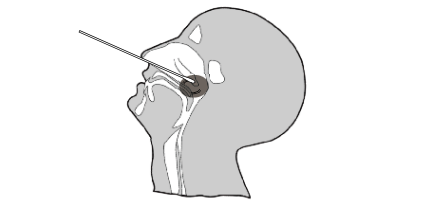 COVID-19 And Influenza A+B Antigen Combo Rapid Test Nasopharyngeal Swab