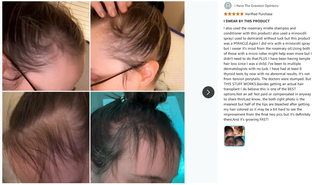 Anti Hair Loss Biotin Enriched Rosemary Mint Hair Regrowth Conditioner Paraben Free OEM
