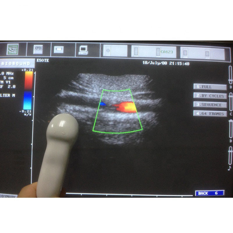 CA123 Convex Array Ultrasound Scan Probe for MyLab 25 Series