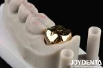 Professional Grade Gold Crown For Dental Oral Clinical Application Yes Abrasive